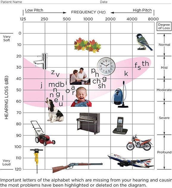 Hearing Tests - (Section 5)